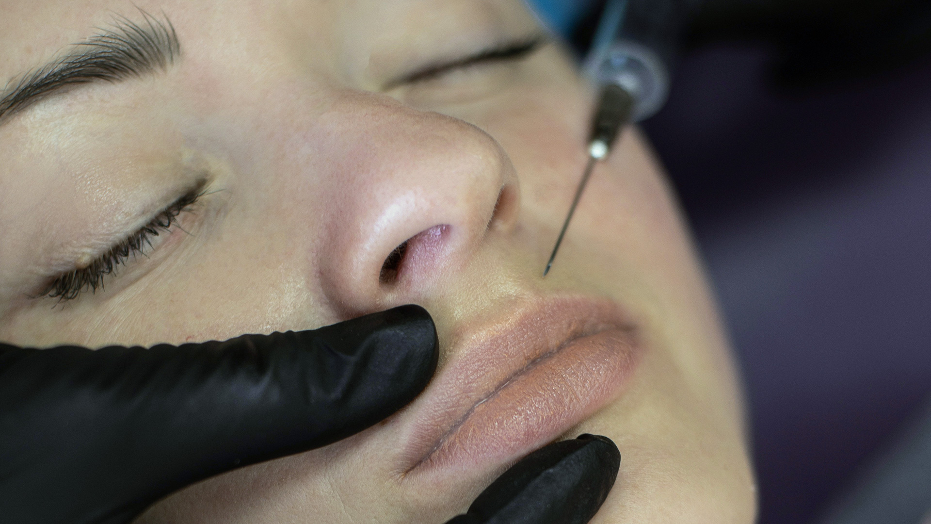 All There is To Know About Botox Injections